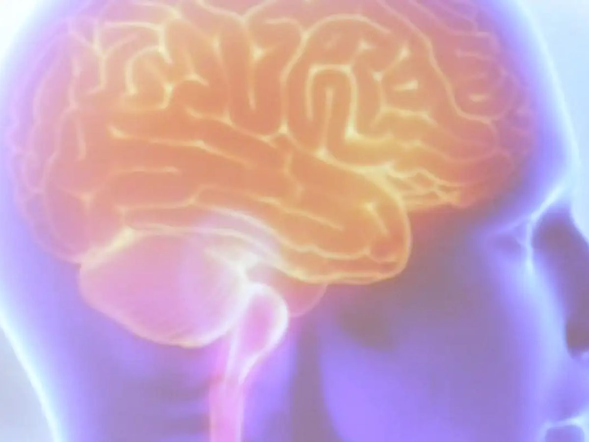 Projeto Ártemis avalia genética de pacientes que sofreram AVC